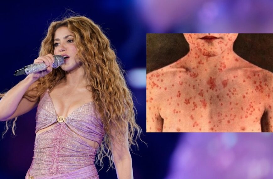 After Shakira Concert: Thousands at Risk of Measles Infection! (Photo: Shakira performs at MetLife Stadium on Friday, May 16, 2025, in East Rutherford, N.J. (Photo by Charles Sykes/Invision/AP)