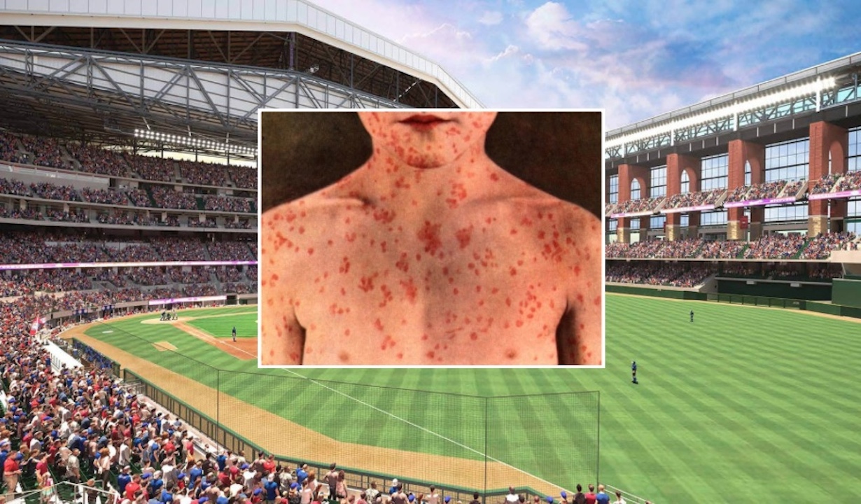 Measles at Rangers vs Dodgers Game, Warning for 40K Attendees