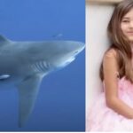 Florida Shark Attack Injures 9-Year-Old Snorkeler (Photo:TODAY/YouTube)