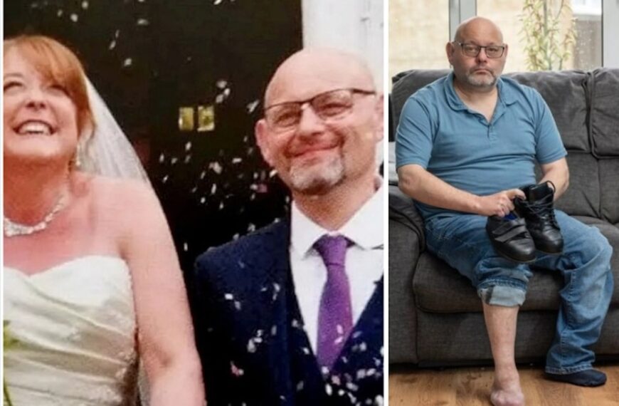 Groom Needs Toes Amputation After Wearing Tight Wedding Shoes (Photo: Mirror UK)