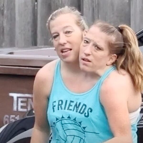 Conjoined Twins Abby and Brittany Hensel Seen with Husband and Dog
