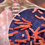 Fear Grows in Maine Over Deadly Disease Cases